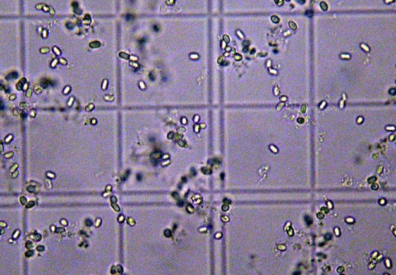 Nosema spores on hemocytometer grid (400x magnification). Photo by Dr. Zachary Huang